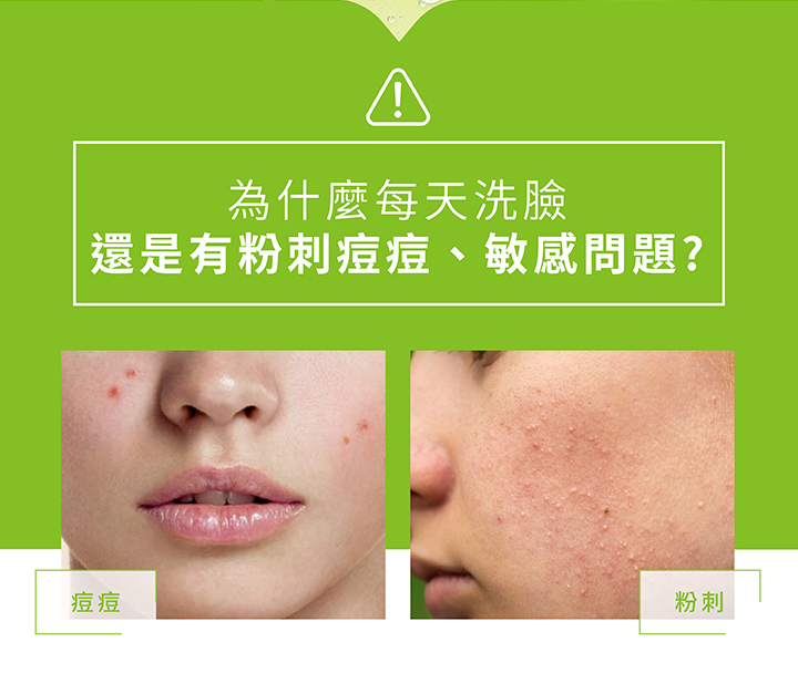 水楊酸粉刺淨痘潔膚露 200ml（最短效期至202603）_2