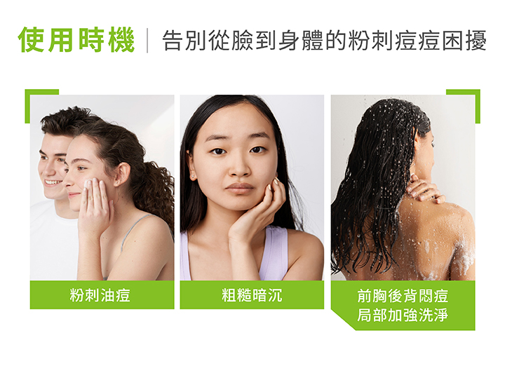水楊酸粉刺淨痘潔膚露 200ml（最短效期至202602）_4